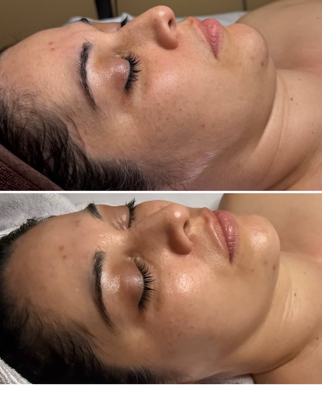 Client results at THE ONE Clinic