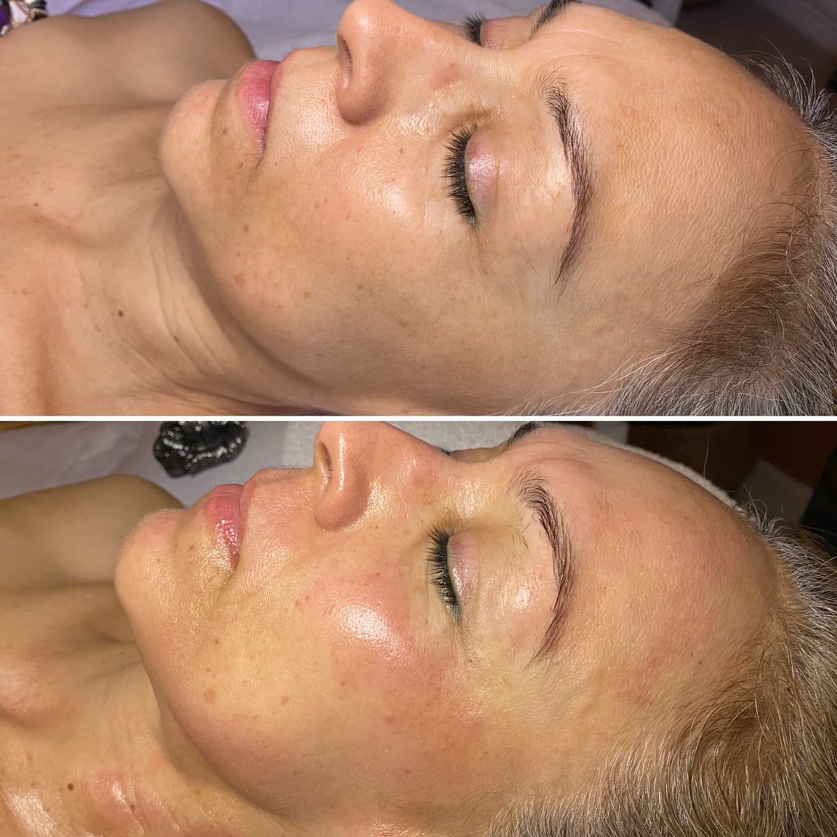 Client before and after result 1