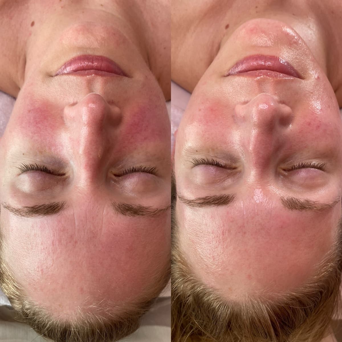 Client before and after result 2