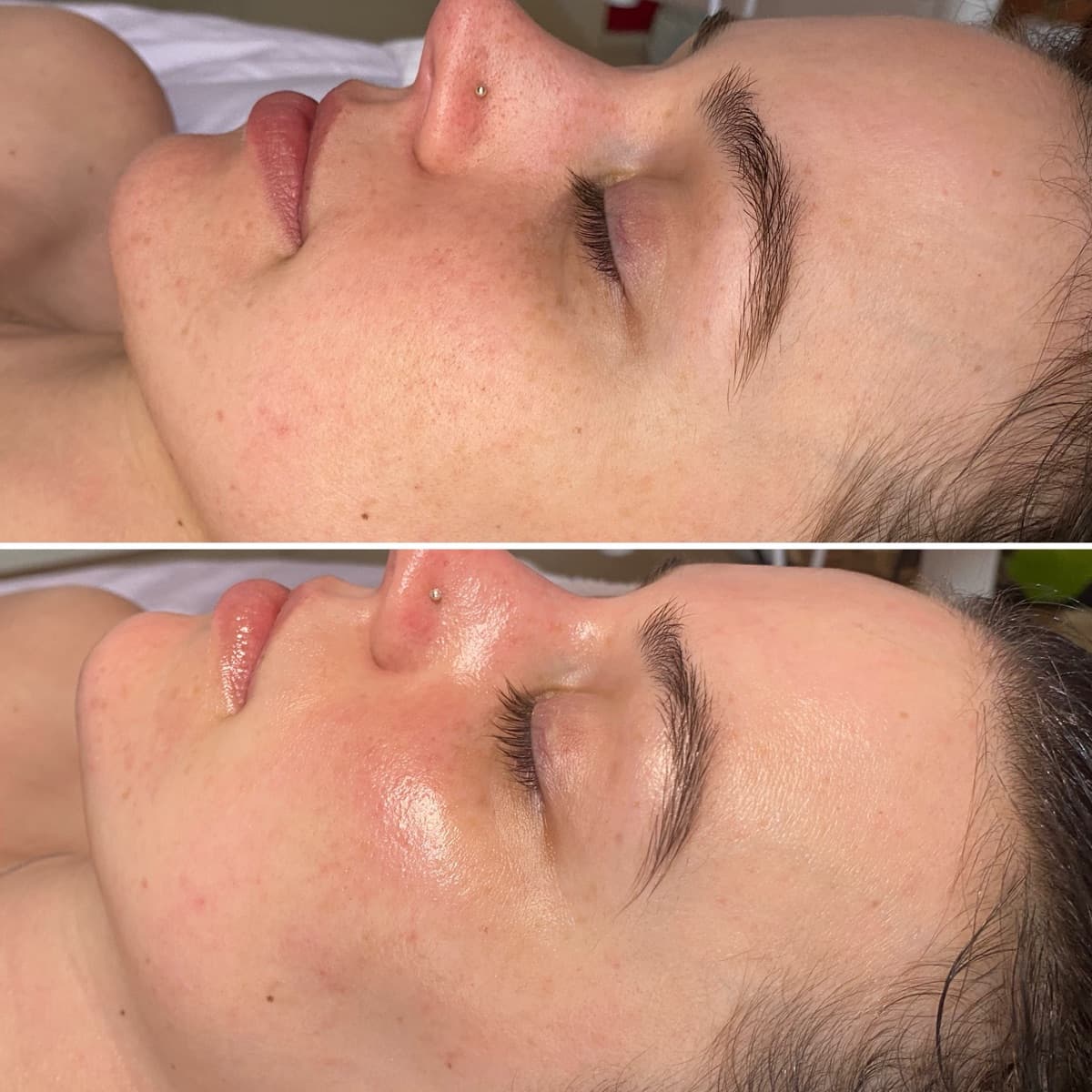 Client before and after result 3
