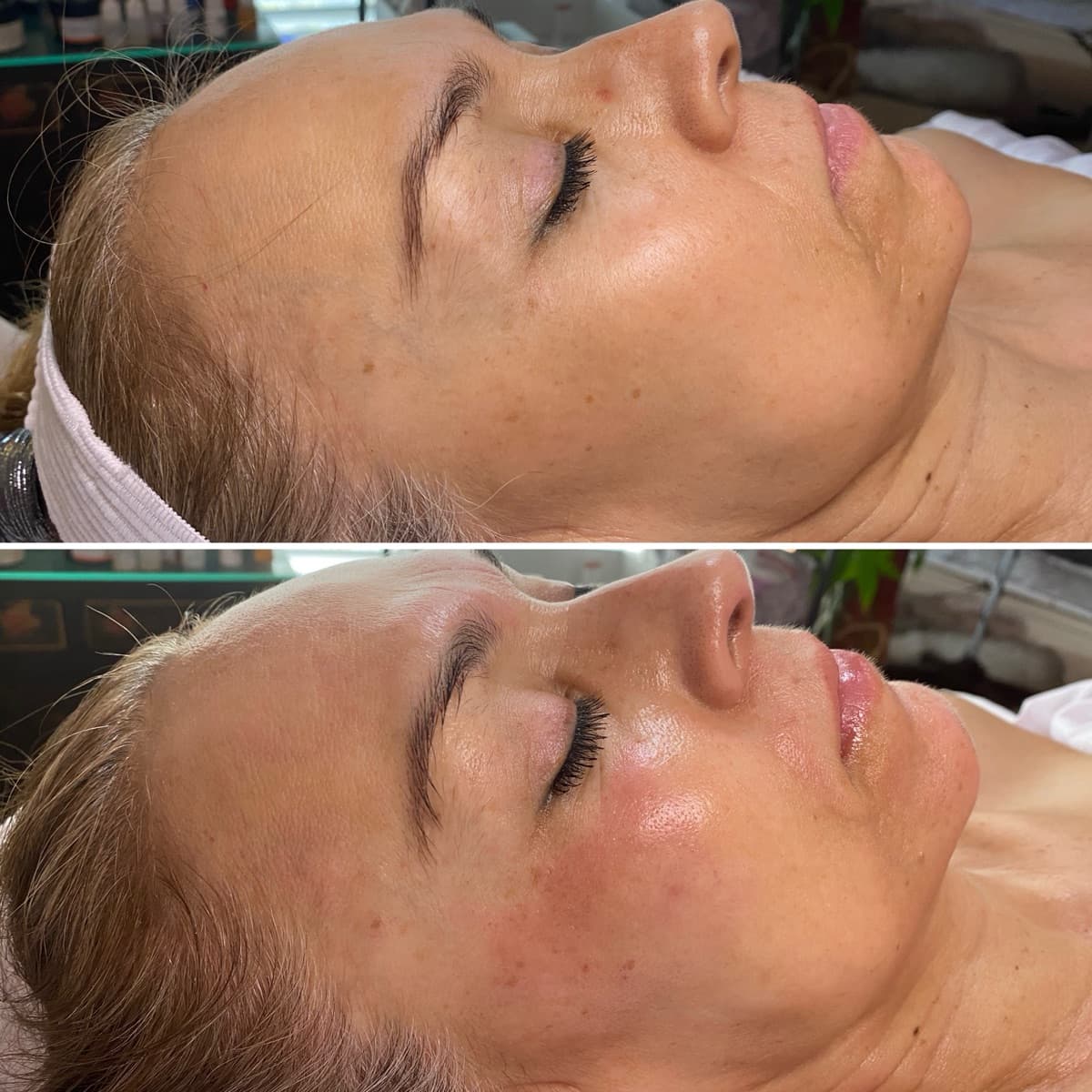 Client before and after result 4
