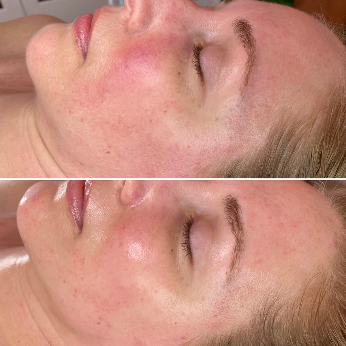 Client before and after result 5