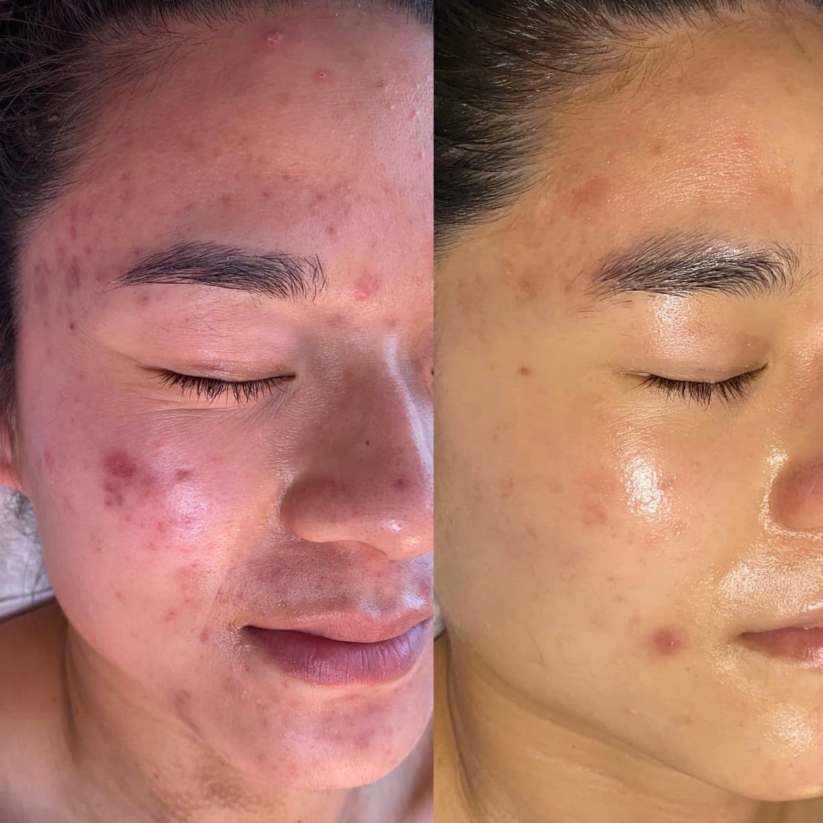 Client before and after result 6