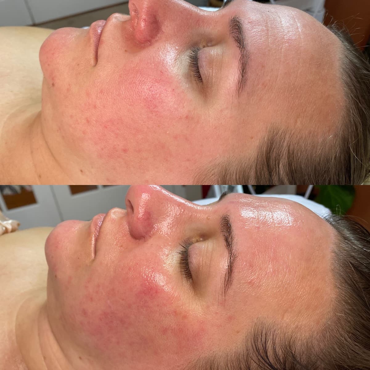 Client before and after result 7