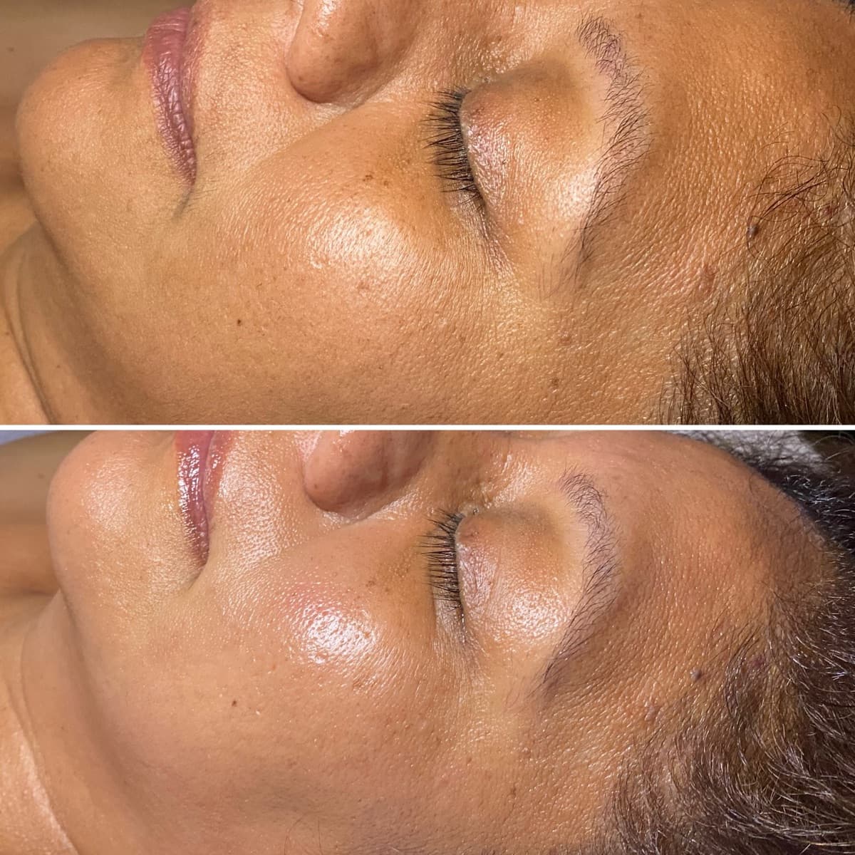 Client before and after result 8