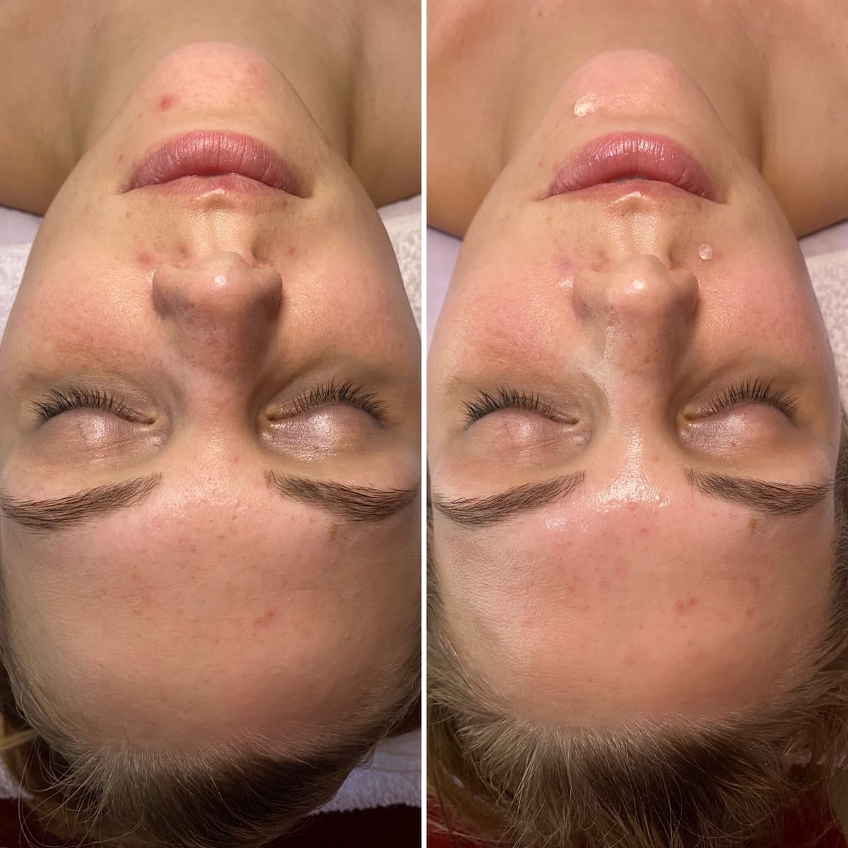 Client before and after result 9
