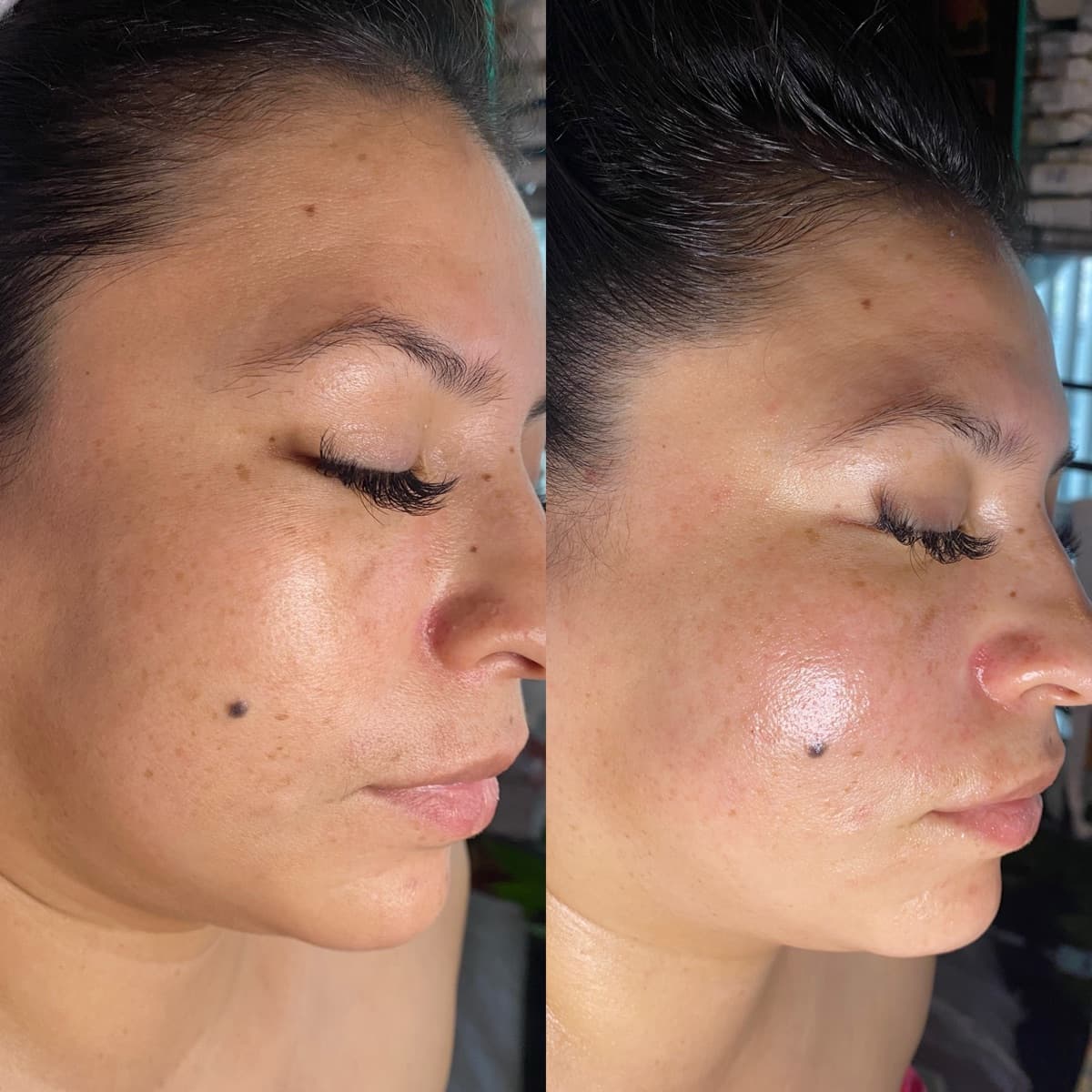 Client before and after result 11