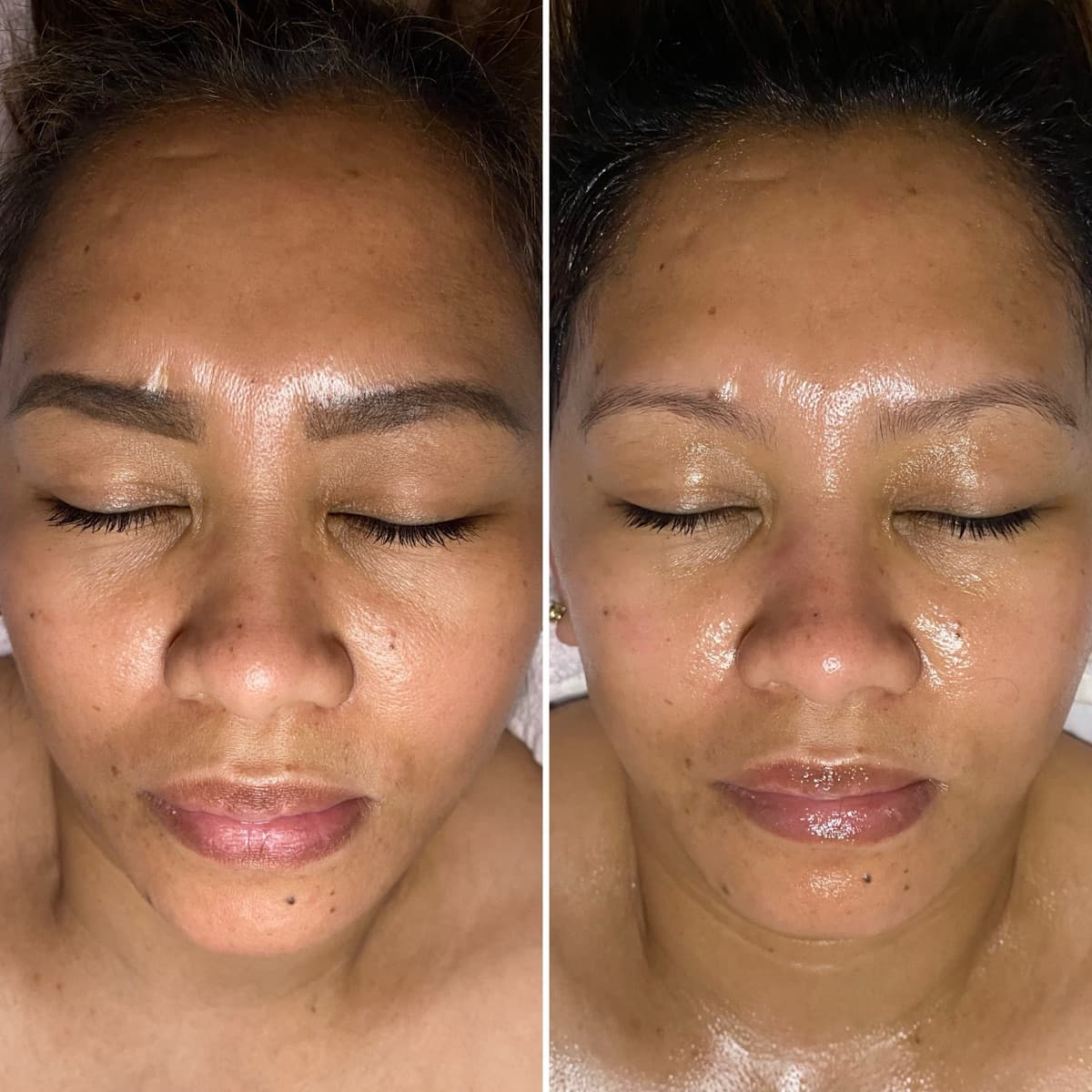 Client before and after result 12