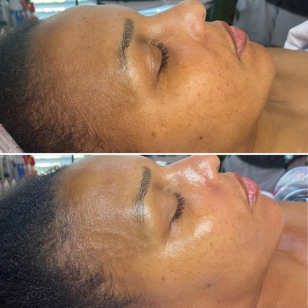 Client before and after result 13