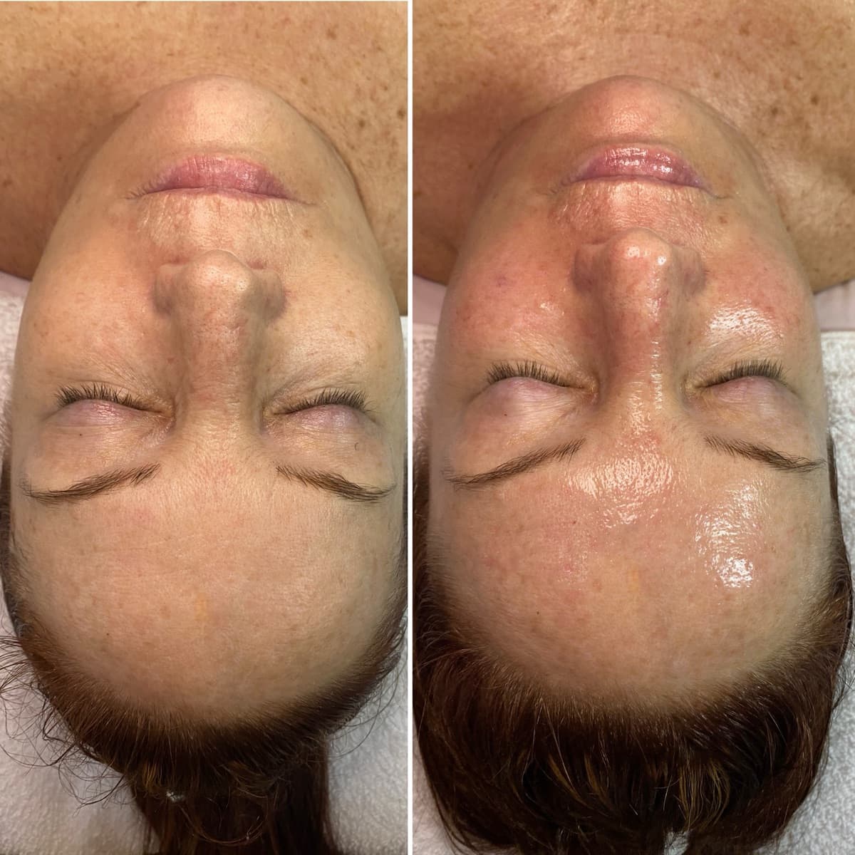 Client before and after result 14