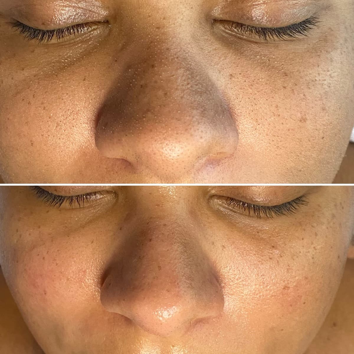 Client before and after result 15