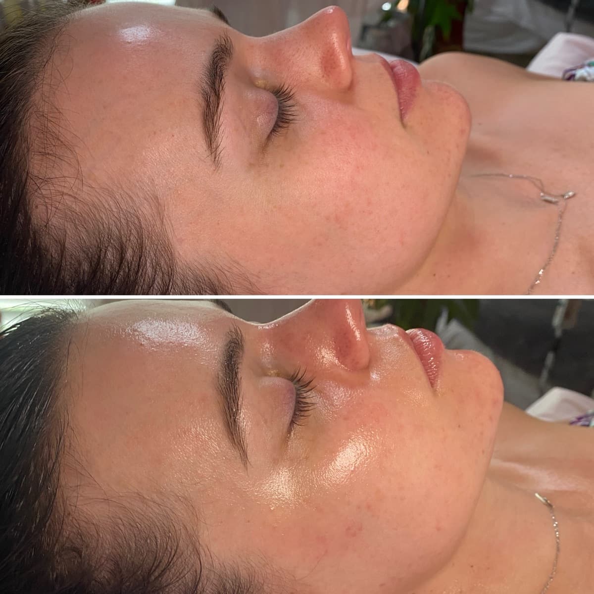 Client before and after result 16