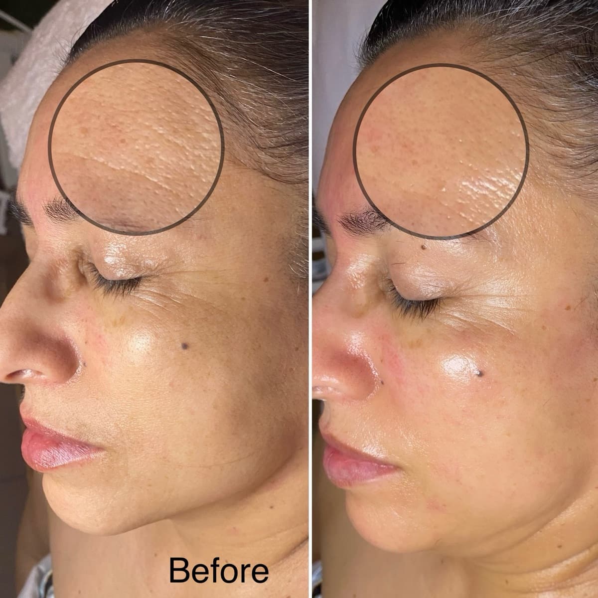 Client before and after result 17