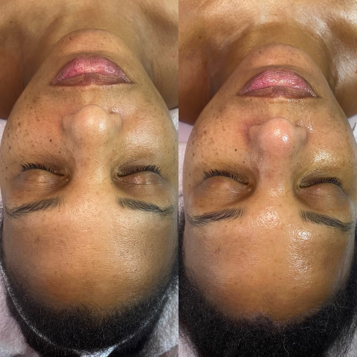 Client before and after result 18