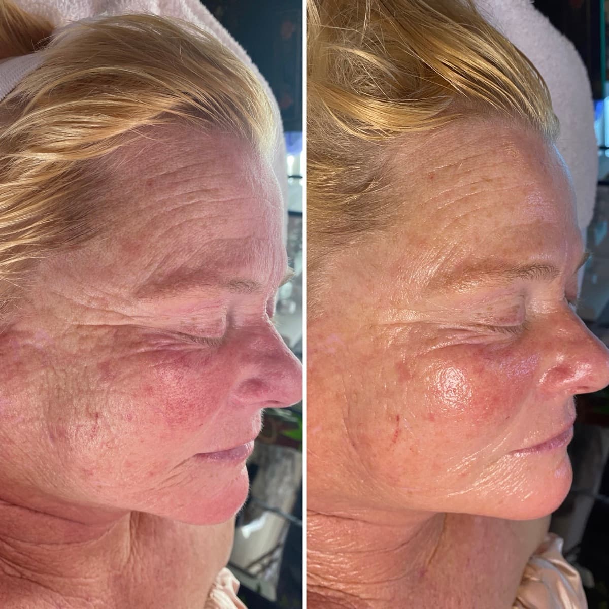 Client before and after result 19