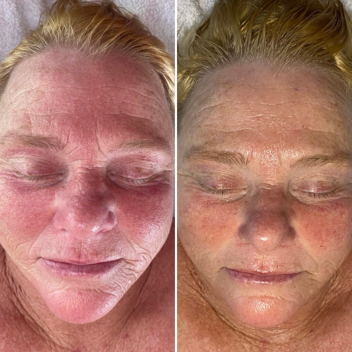 Client before and after result 20