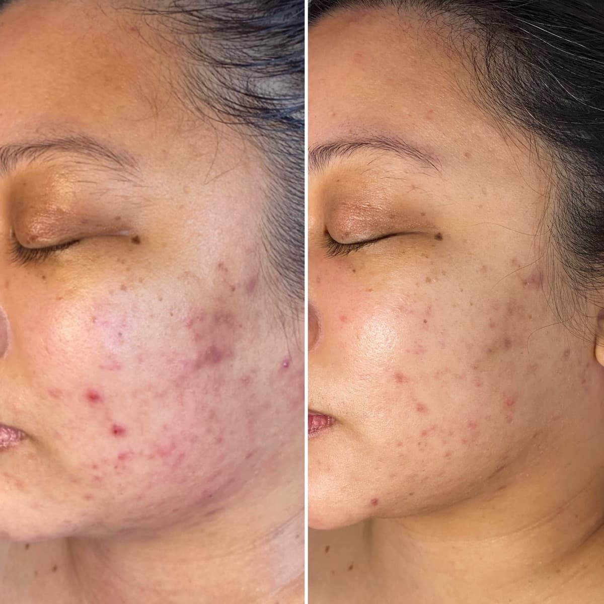 Client before and after result 21