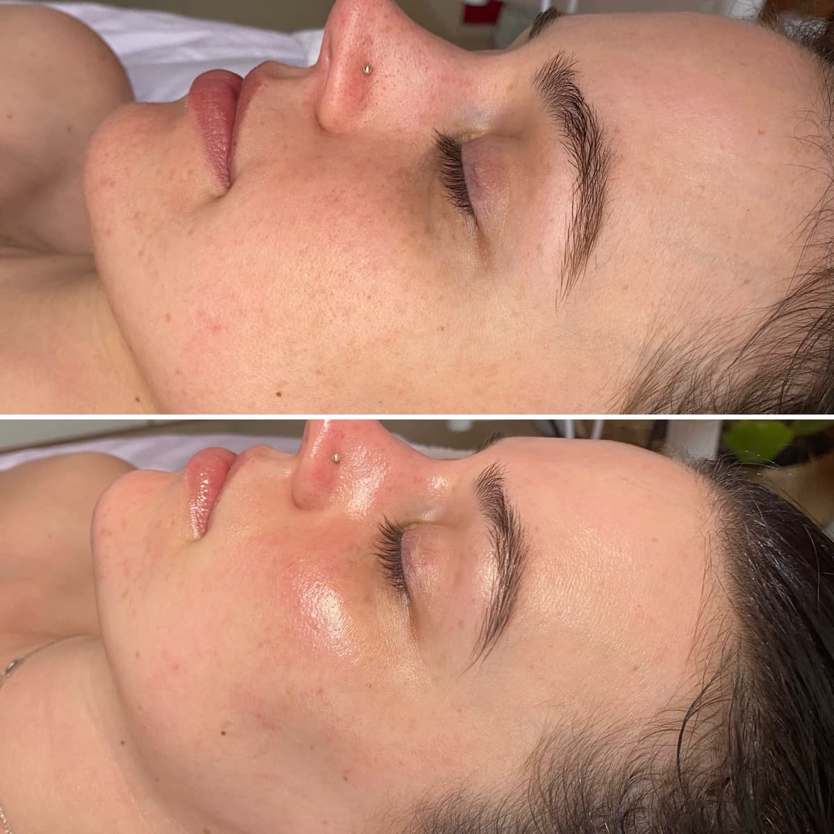 Client before and after result 22