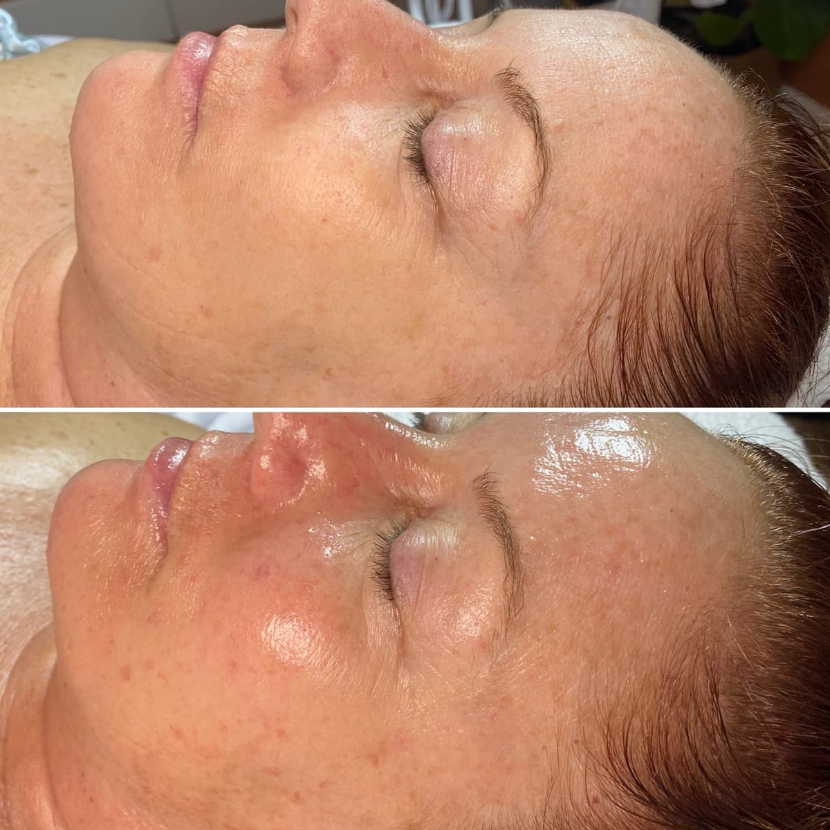 Client before and after result 23
