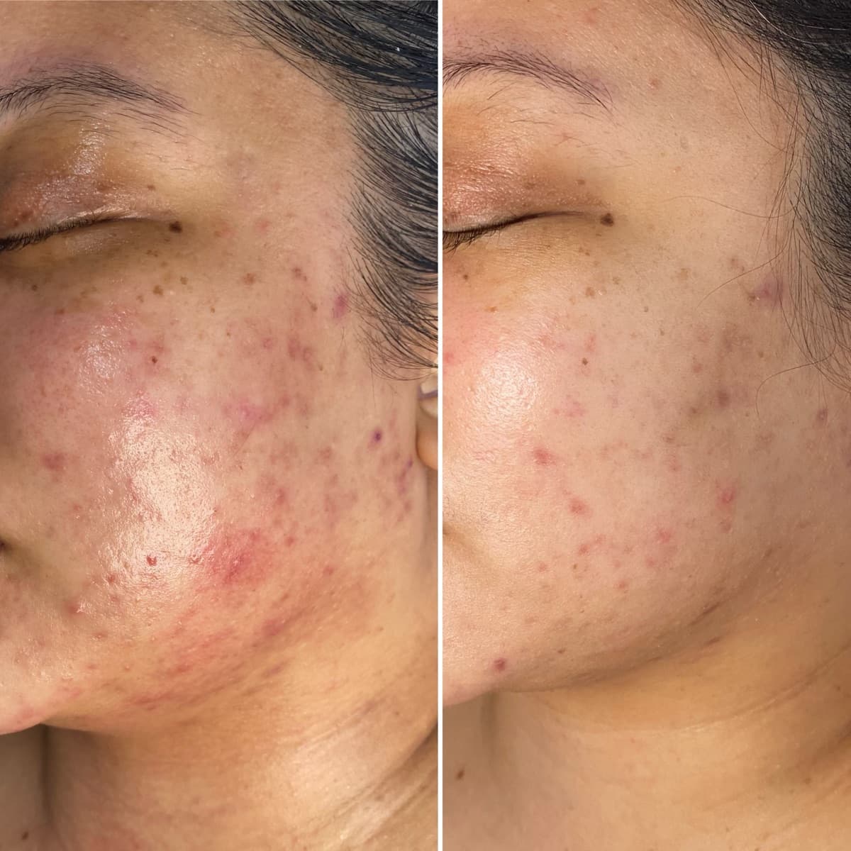 Client before and after result 24