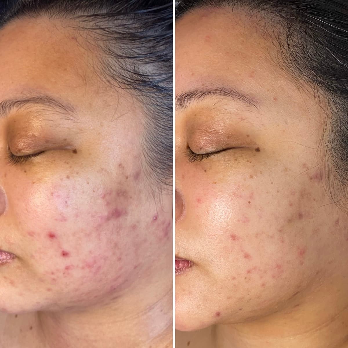 Client before and after result 25