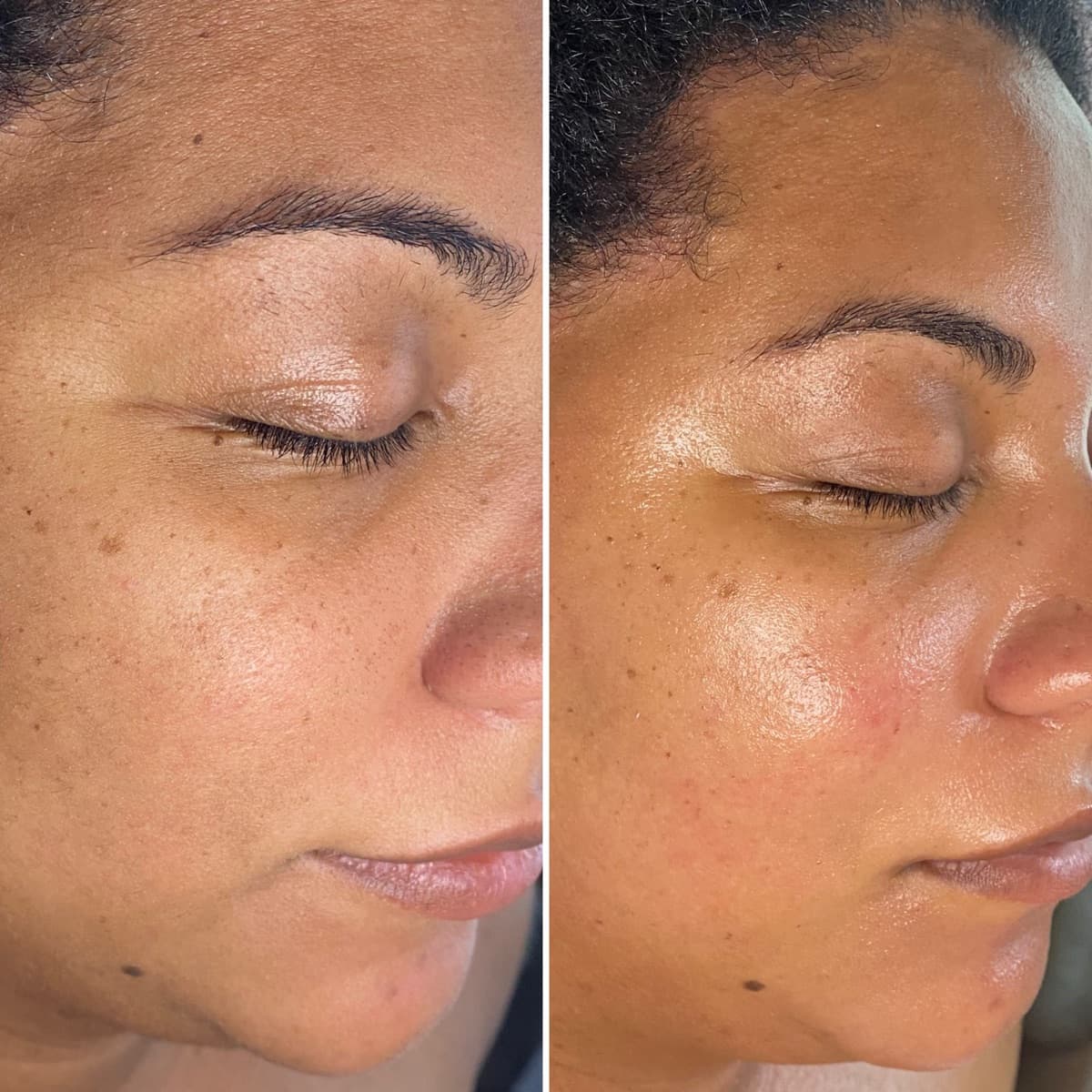 Client before and after result 26