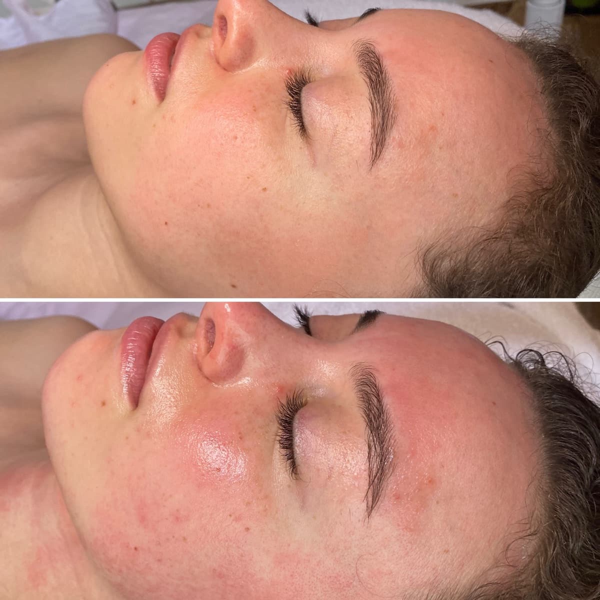 Client before and after result 27