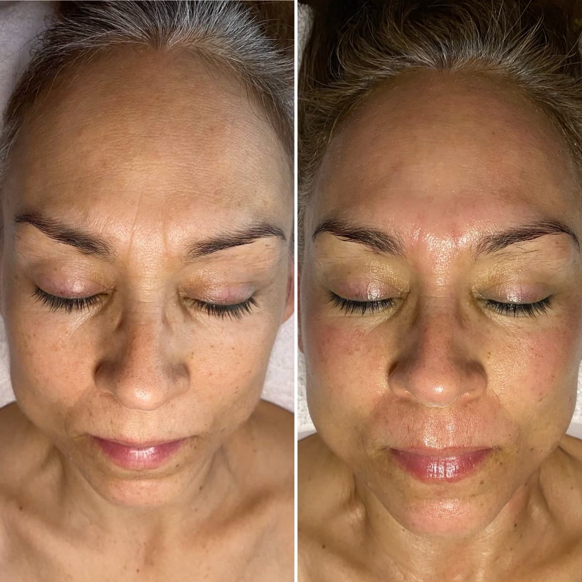 Client before and after result 28