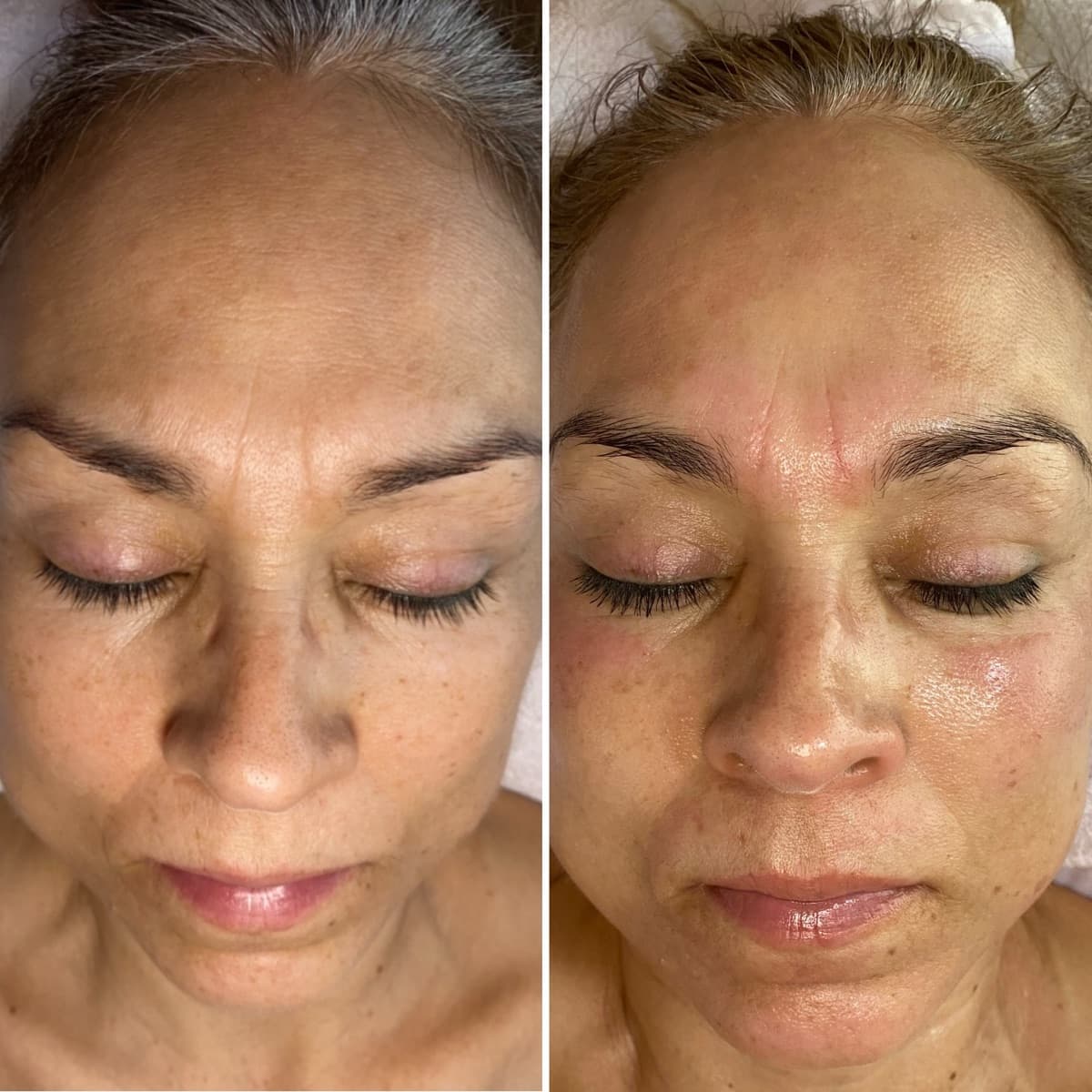 Client before and after result 29