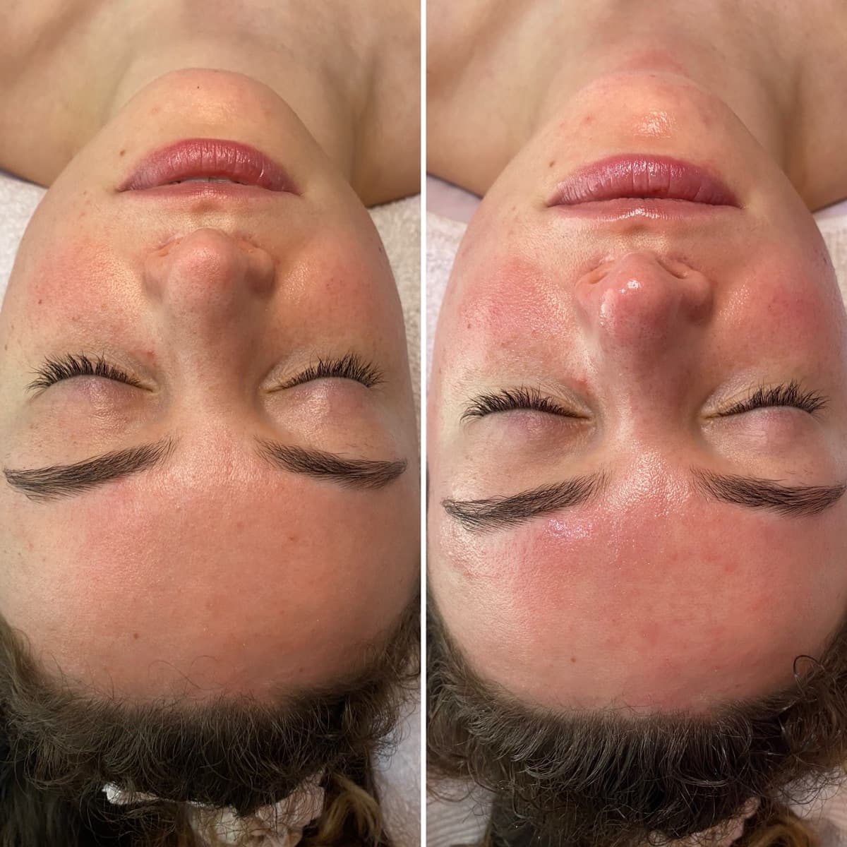 Client before and after result 30
